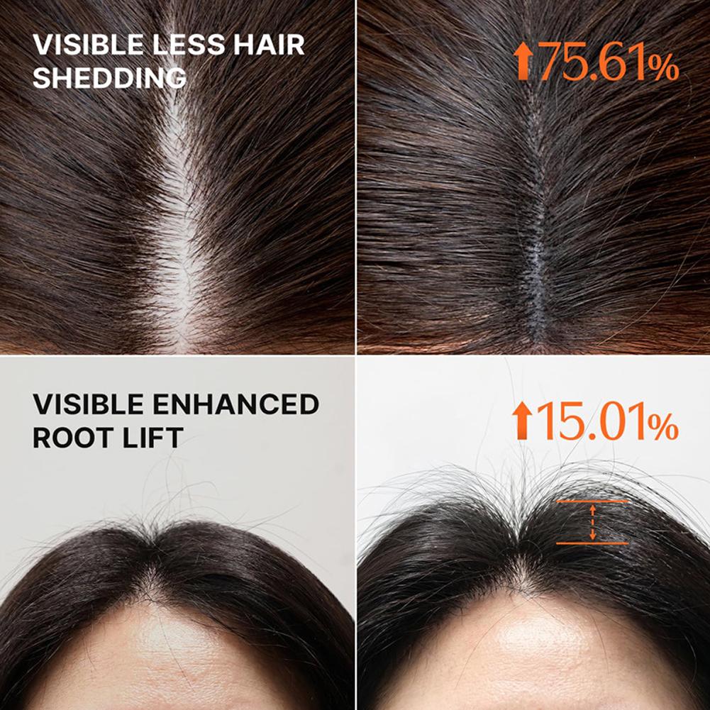 GROW:TURN 3D Шампунь для объем – обзор и цена Hair Care For Hair Fall