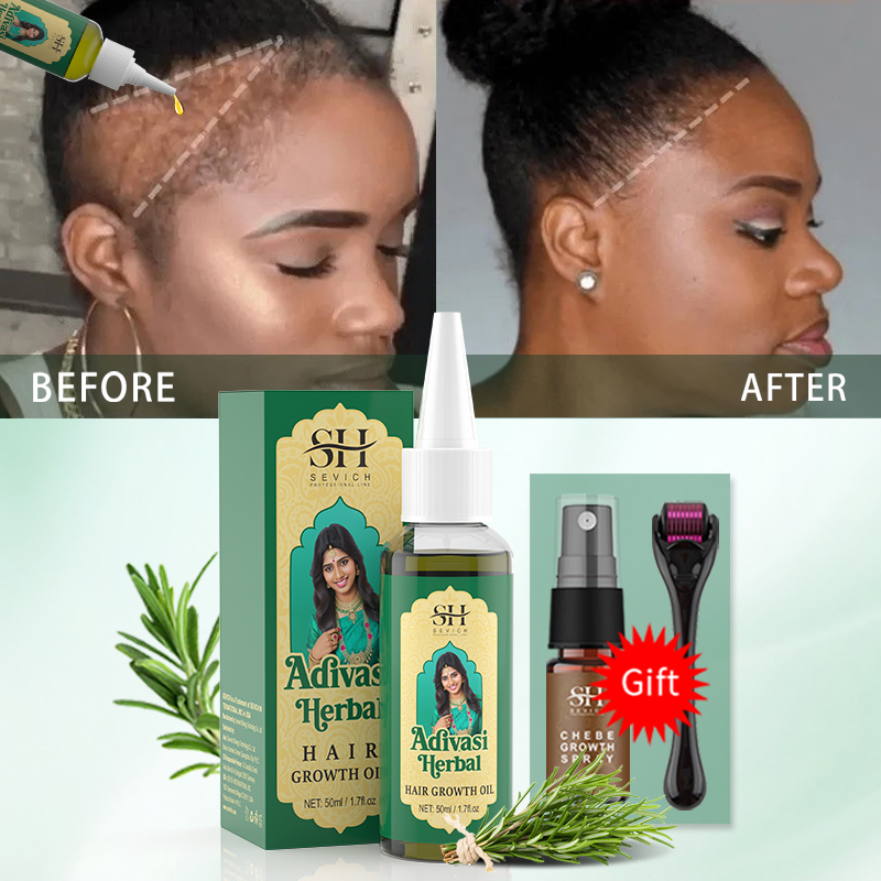 Аюрведическое масло для роста  – обзор и цена Hair Care Essence Oil Spray