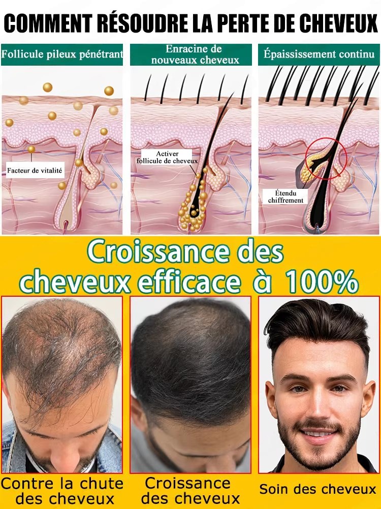 Натуральная имбирная эссенция  – обзор и цена Hair Care For Hair Fall