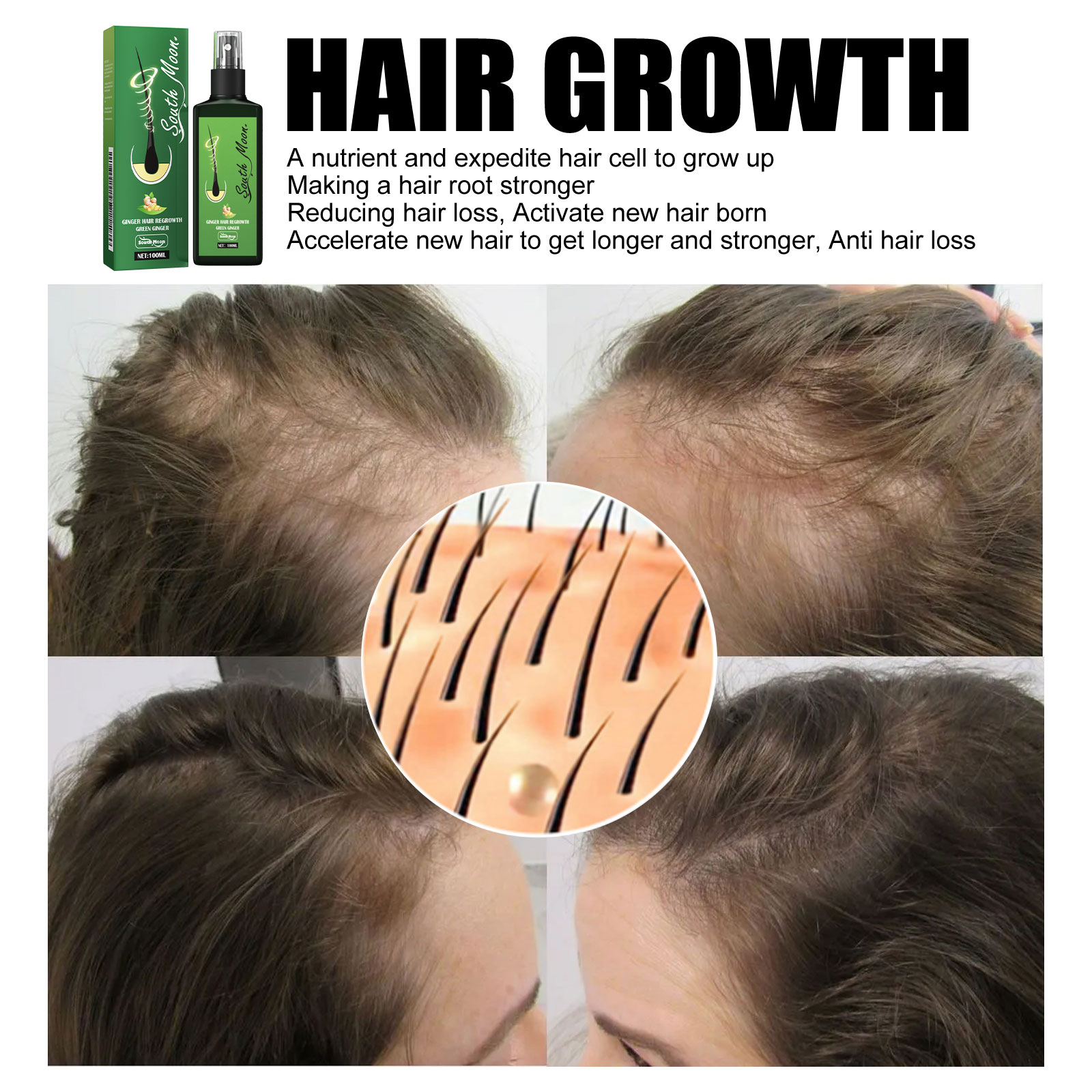 Спрей-сыворотка для густоты во – обзор и цена Hair Care For Hair Fall