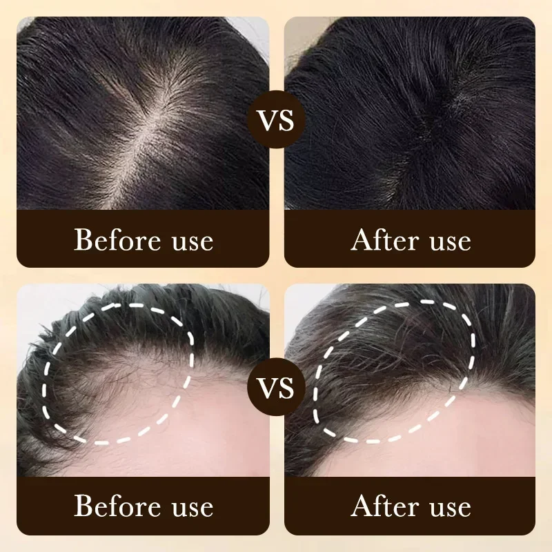 Биотиновое масло для быстрого  – обзор и цена Hair Care Essence Oil Spray